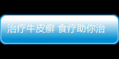 治疗牛皮癣 食疗助你治牛皮癣